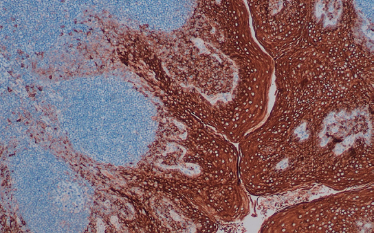EMA 抗体试剂(免疫组织化学)