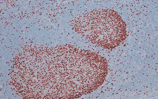 Ki-67 抗体试剂(免疫组织化学)
